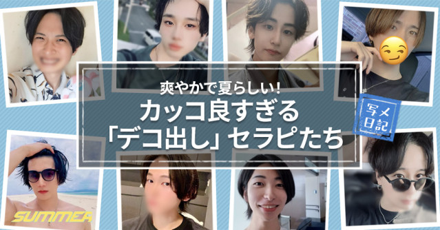 爽やかで夏らしい!カッコ良すぎる「デコ出し」セラピたち♡