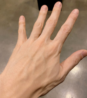 手