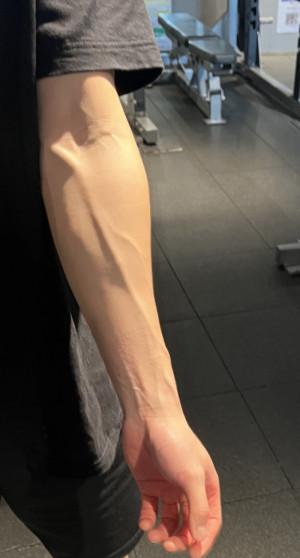 ?