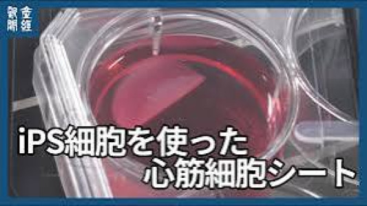 iPS細胞