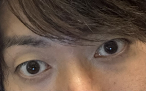 暑