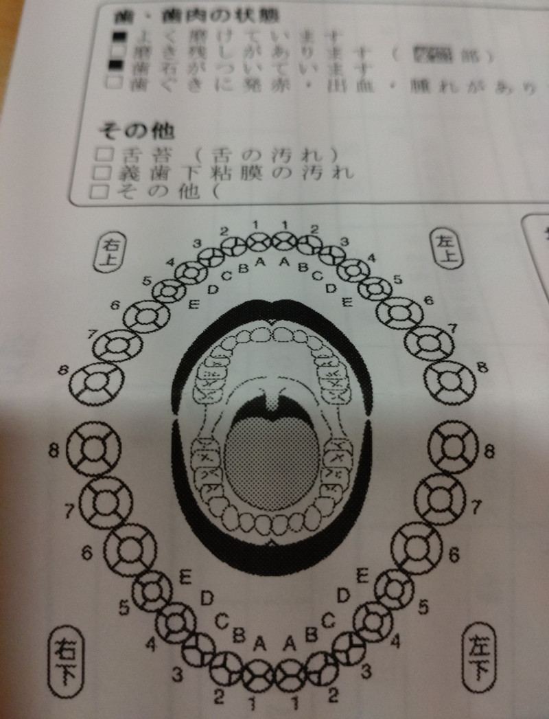 口腔ケア