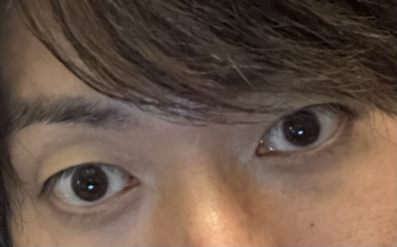 暑