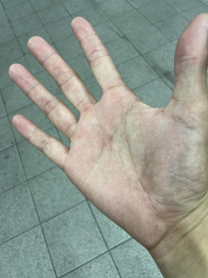 て