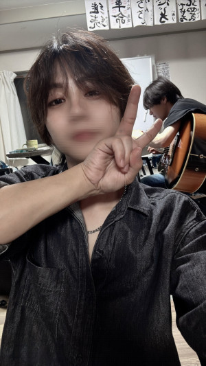 前歯治療中です。笑（欠けた）