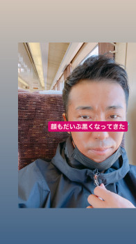 日焼け