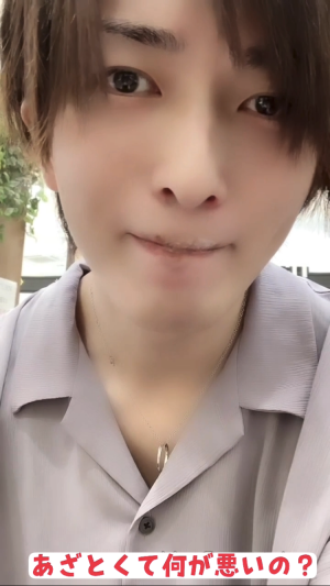あざとい