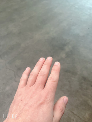 ネイル