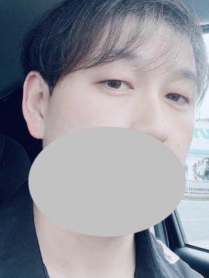 慣れ