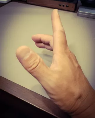 右手指の関節について